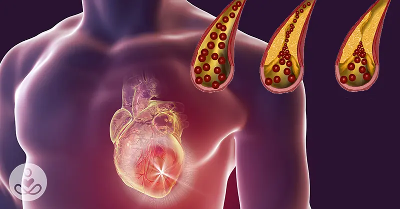 10 Foods That You Should Eat Daily For Clean Arteries