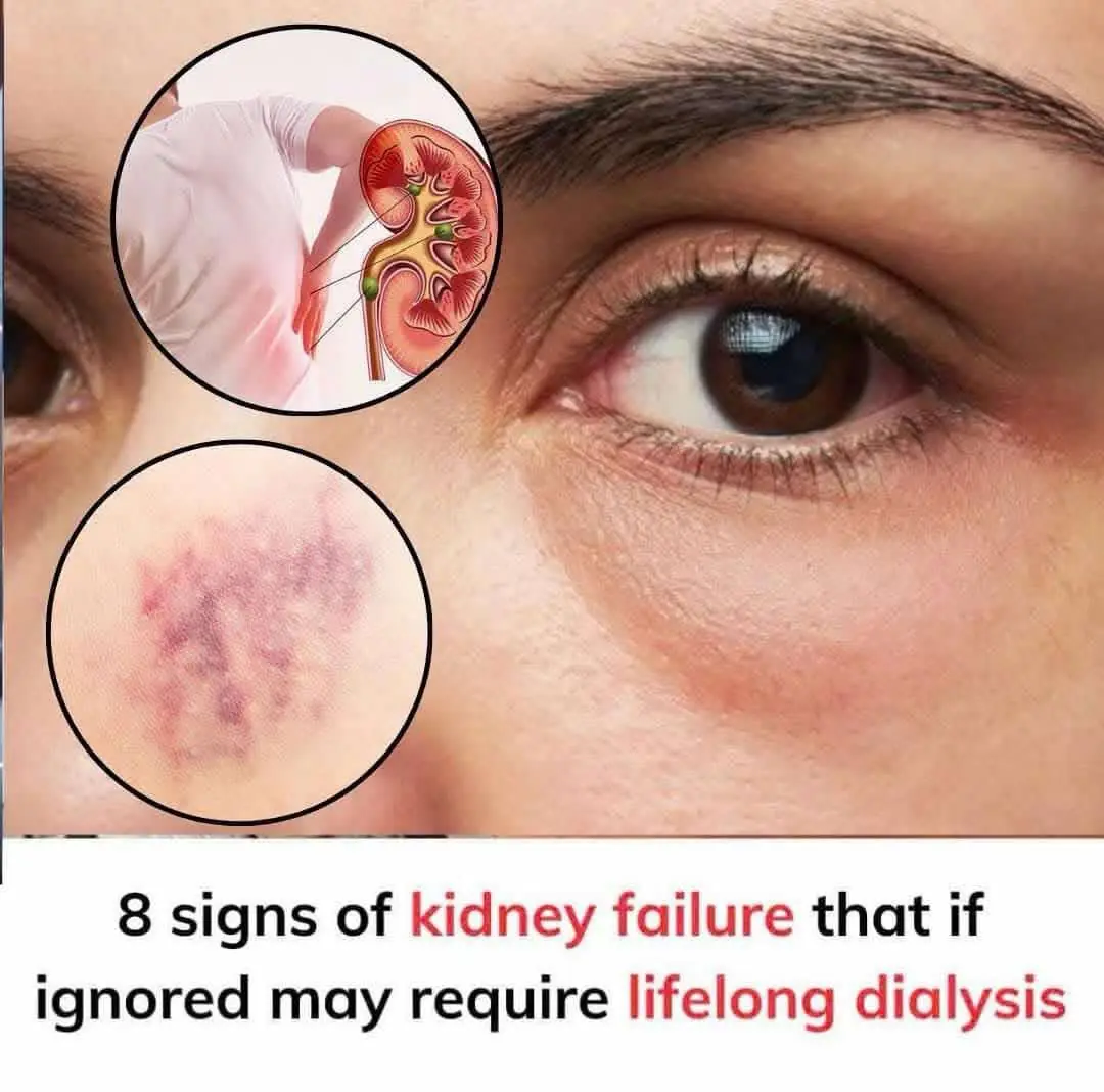 10 Warning Signs Your Kidneys May Be in Danger