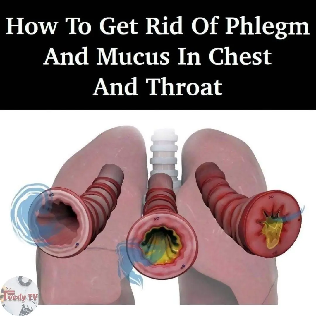 8 Ways To Get Rid Of Phlegm And Mucus In Chest And Throat 👇