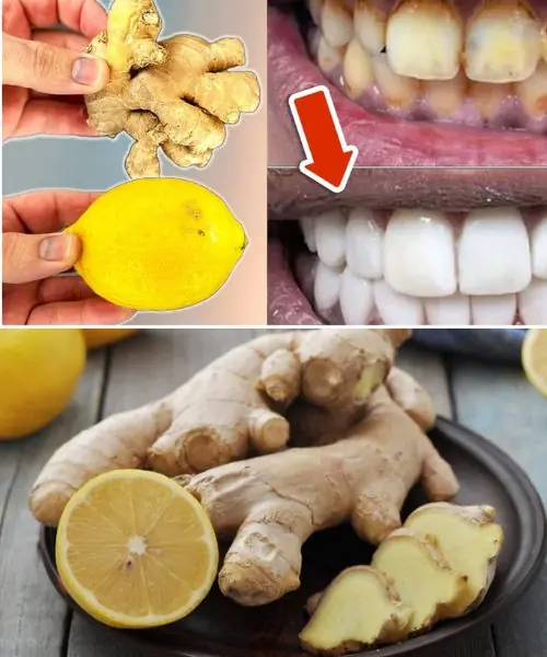 Transform Yellow Teeth to Milky White and Shiny in Just 2 Minutes with Lemon and Ginger!