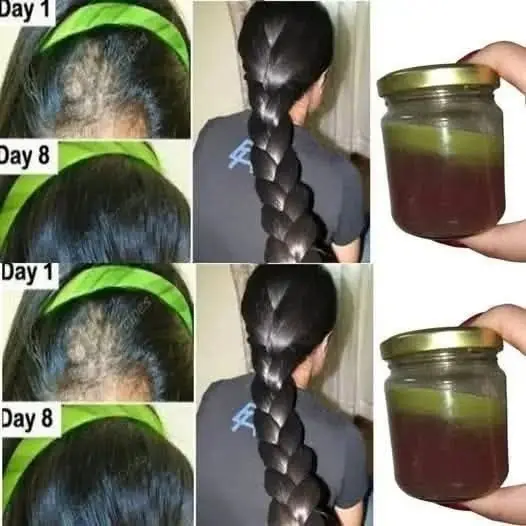 The Indian Secret to Rapid Hair Growth and Combating Baldness