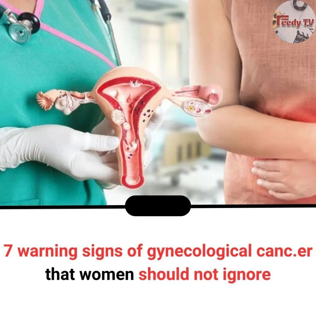 7 Warning Signs of Gynecological Cancer That Women Should Not Ignore