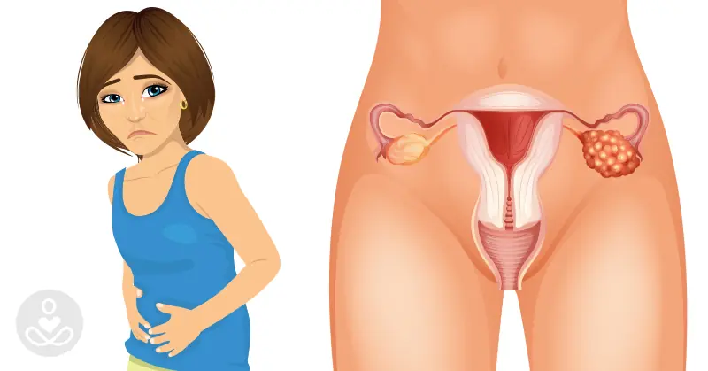 4 Early Symptoms Of Ovarian Cancer That Every Woman Needs To Know