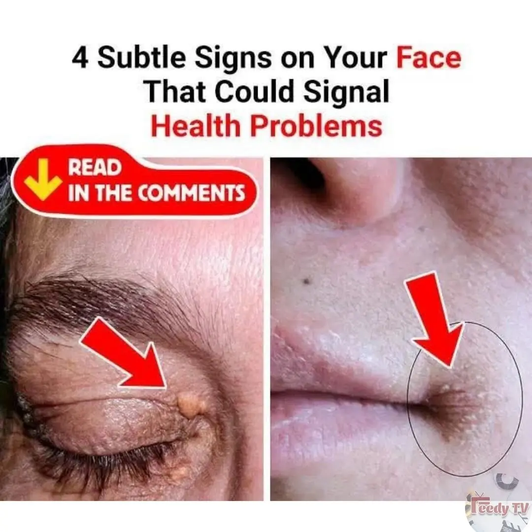 4 Face Signs That Could Reveal Hidden Health Issues