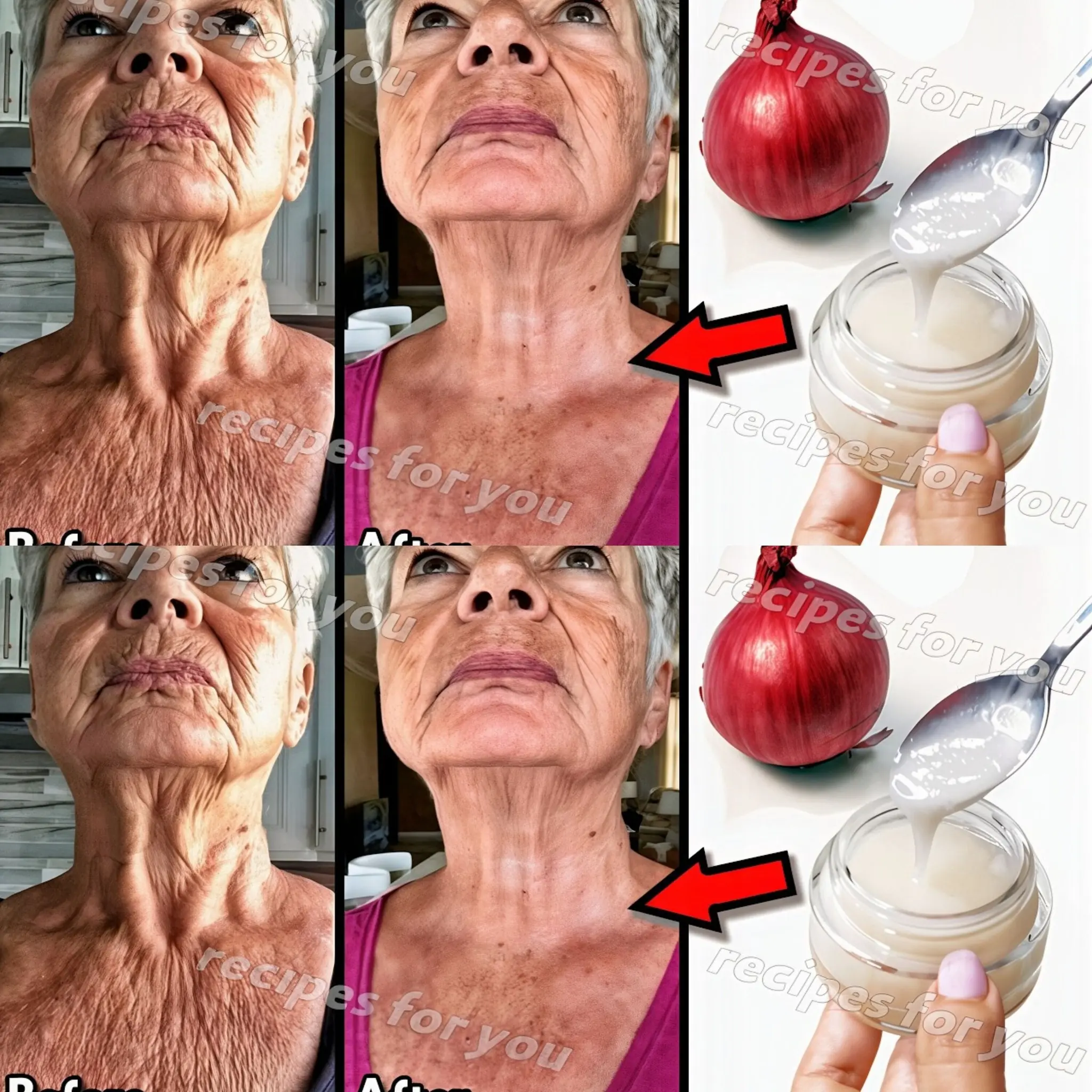 Uncategorized Ditch Sagging Skin with Tomato Onion Skin-Tightening Remedies for a Youthful Glow