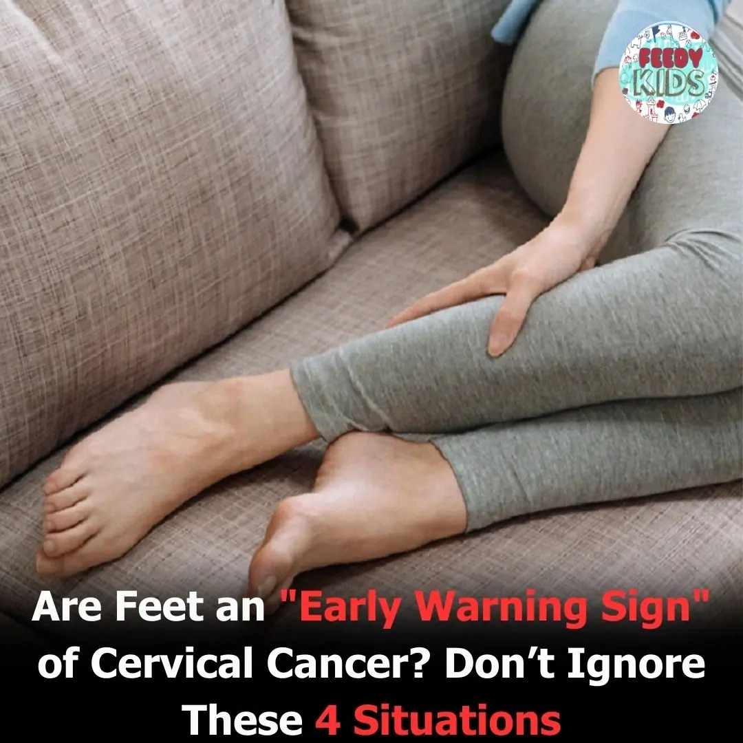 Are Feet an "Early Warning Sign" of Cervical Cancer? Don’t Ignore These 4 Situations