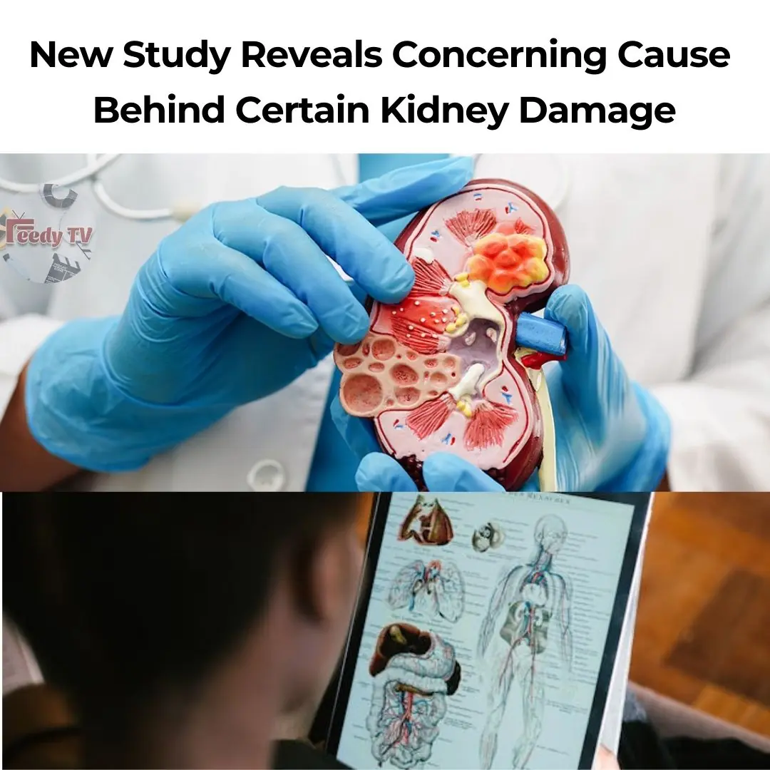 New Study Reveals Concerning Cause Behind Certain Kidney Damage