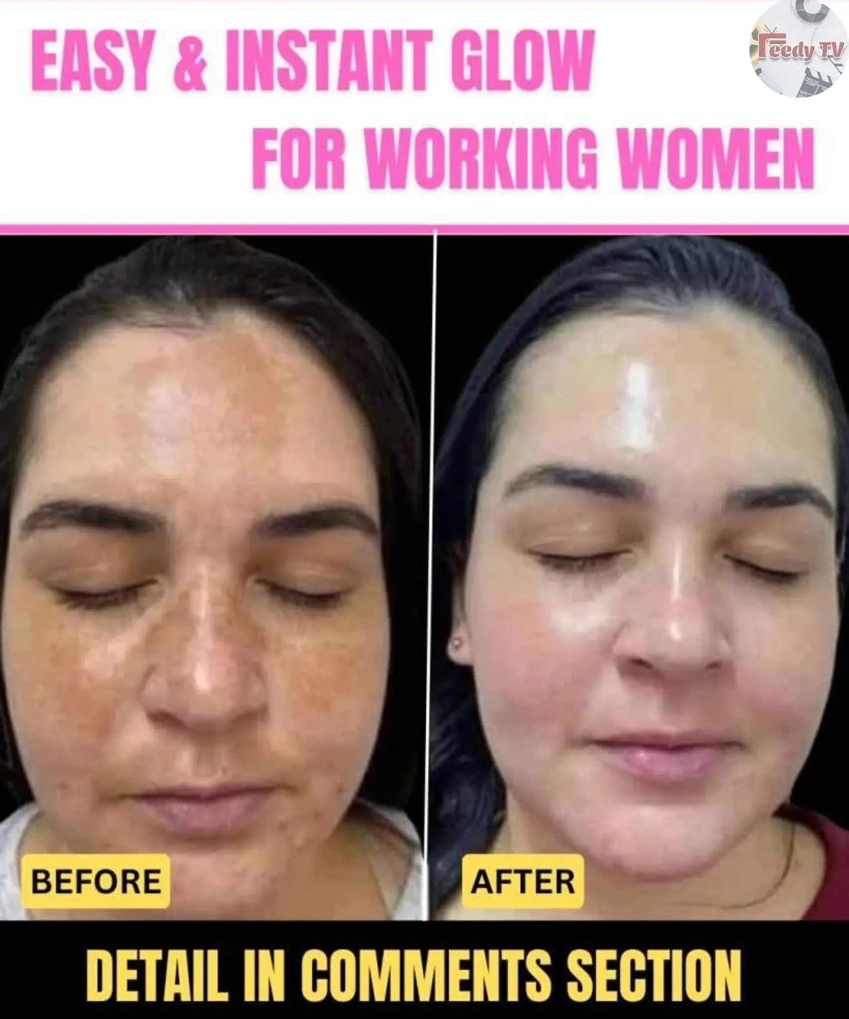 Instant Glow for Working Women: Effective Home Remedies for All Skin Types