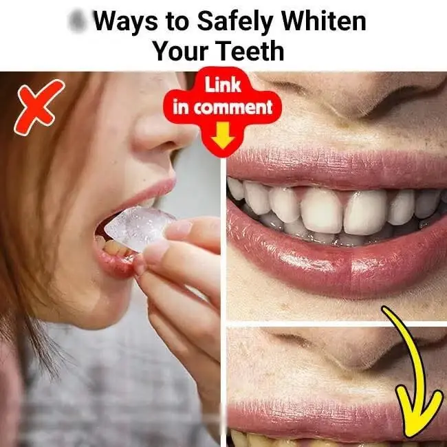 6 Effective and Safe Ways to Naturally Whiten Your Teeth