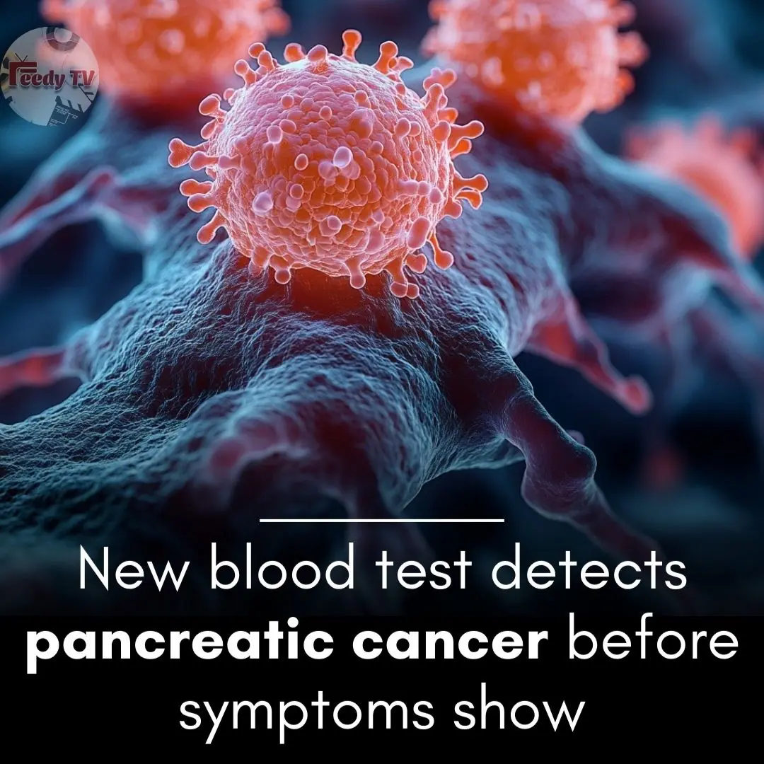 New blood test identifies hard-to-detect pancreatic cancer with 85% accuracy