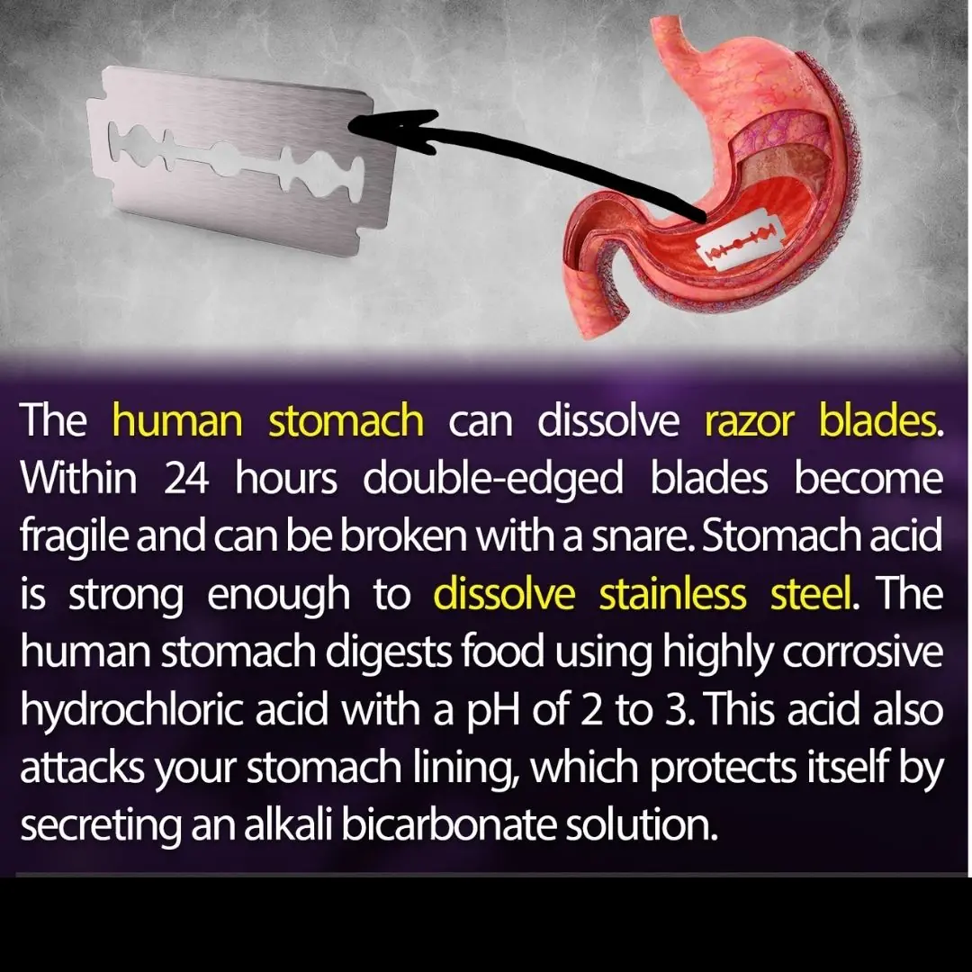 Human Stomach Can Dissolve Stainless steel.