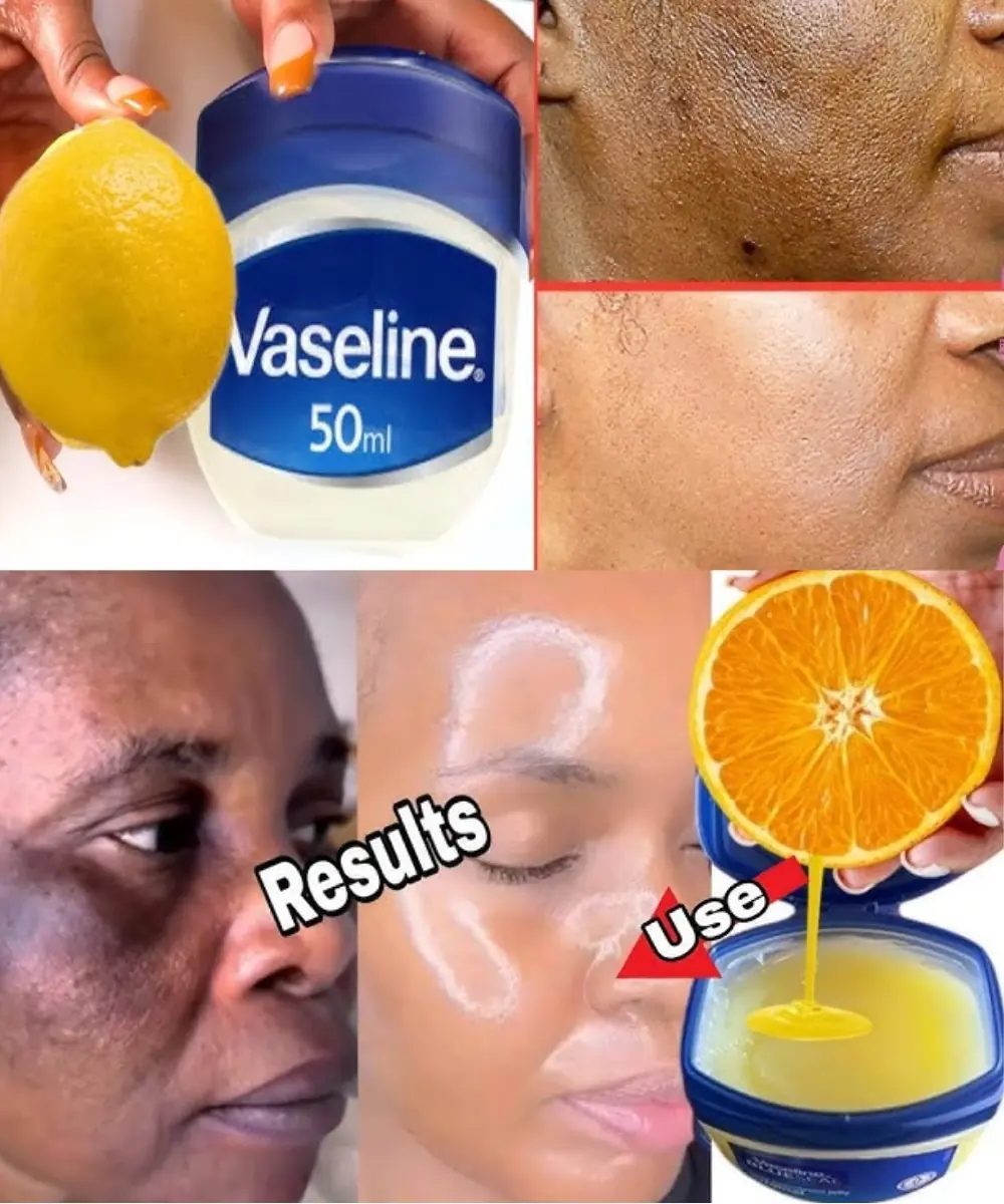 Vaseline and Lemon for Clear, Glowing Skin: A Simple Guide