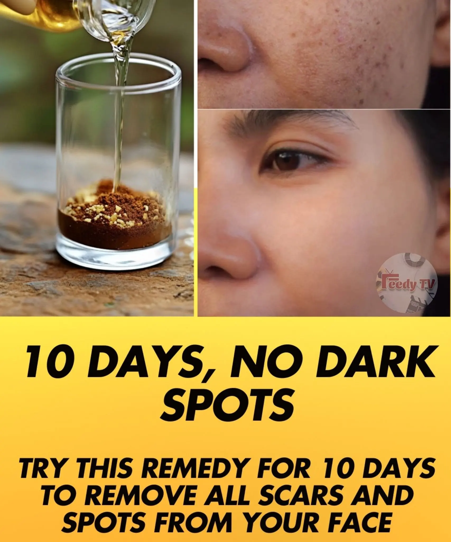 10 Days Licorice Treatment To Remove Dark Spots