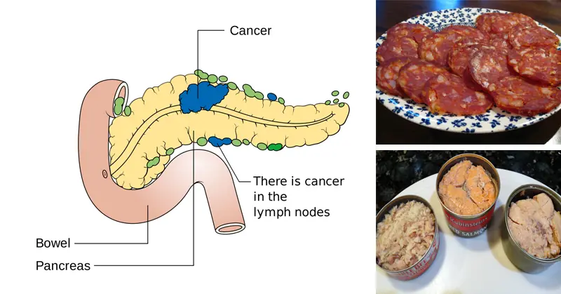 10 Cancer-Linked Foods You Should Never Put in Your Mouth Again