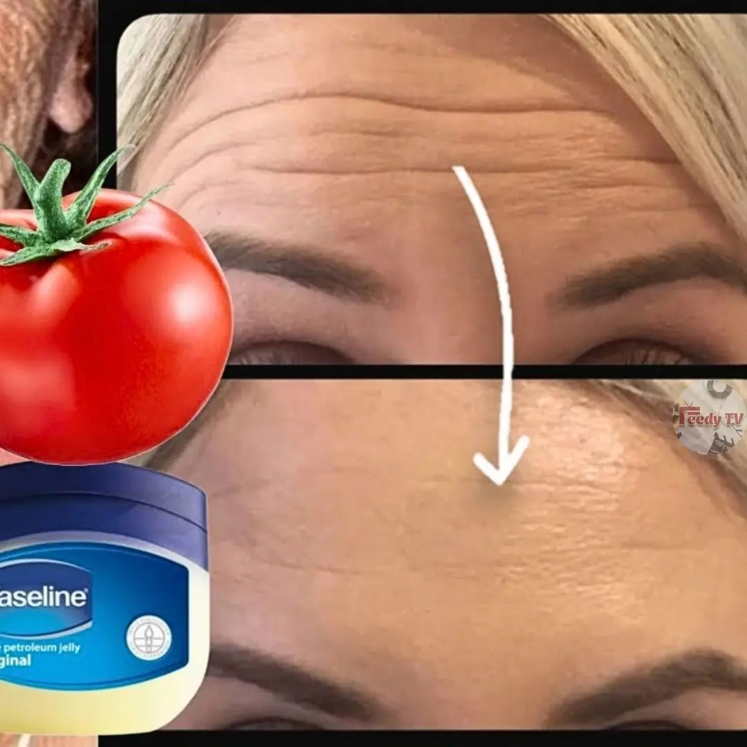 Vaseline and Tomato Combo: The Ultimate Remedy for Sunburn, Dark Circles, and Wrinkles