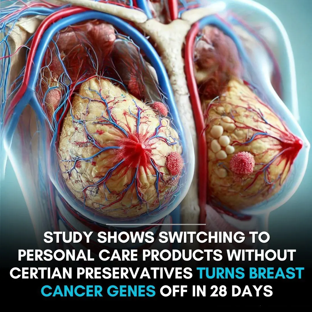 Reduction of daily-use parabens and phthalates reverses accumulation of cancer-associated phenotypes within disease-free breast tissue of study subjects