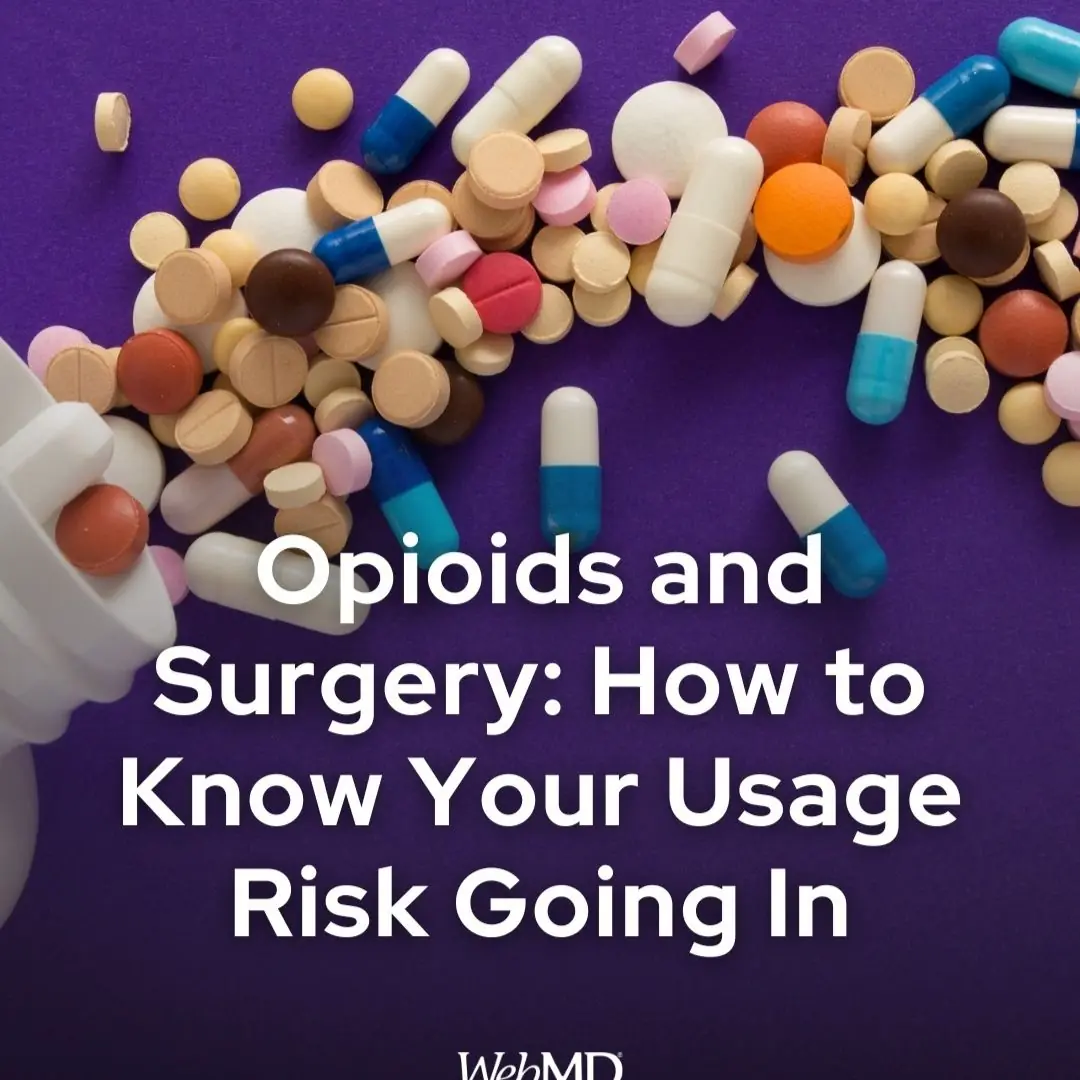 Opioids and Surgery: How to Know Your Usage Risk Going In