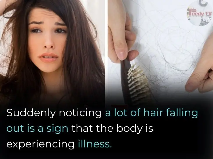 Hair Loss? This Could Be a Sign of Iron Deficiency