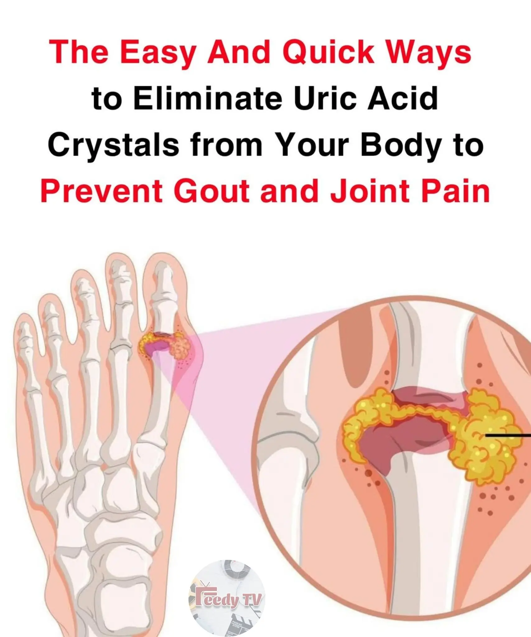 How To Help Naturally Reverse Gout And Relieve Joint Pain