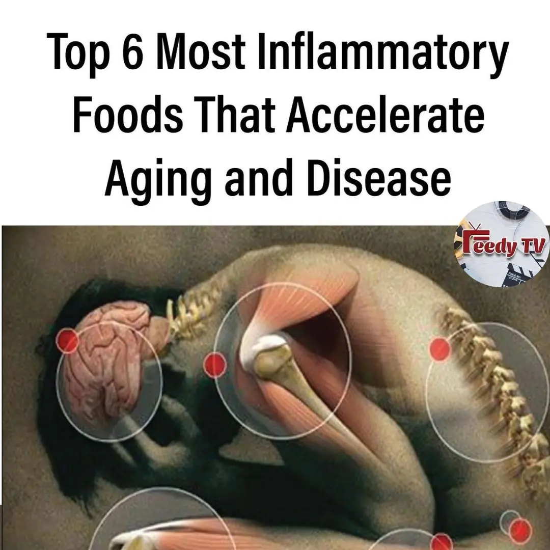 The Top Foods That Cause Chronic Inflammation in the Body