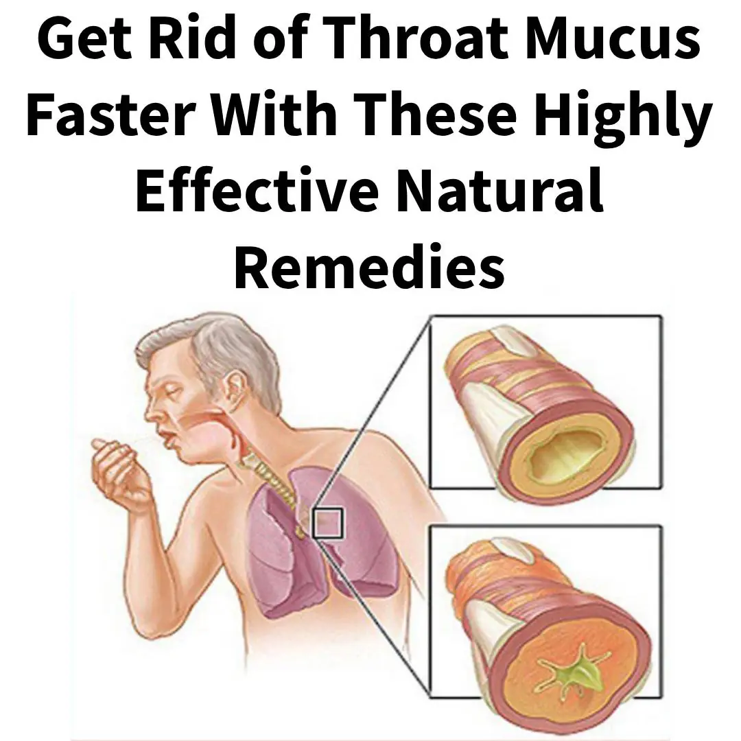 Get Rid of Throat Mucus Faster With These Home Treatments (Evidence Based)