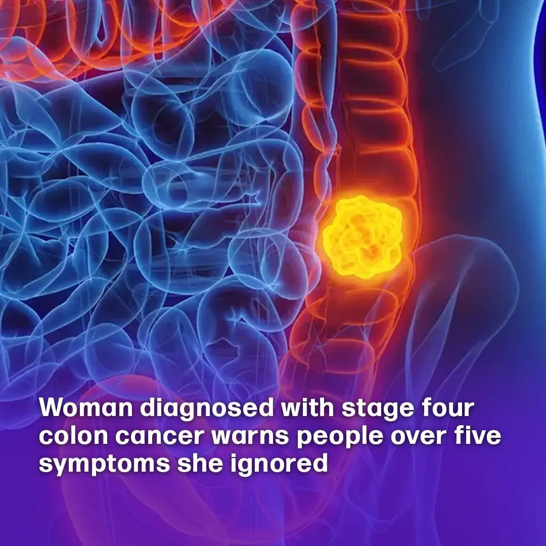 Woman reveals five colon cancer symptoms that should not be ignored