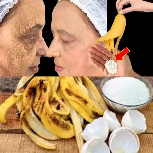 Follow This Banana Peel Remedy If You Are Longing For Spotless Skin