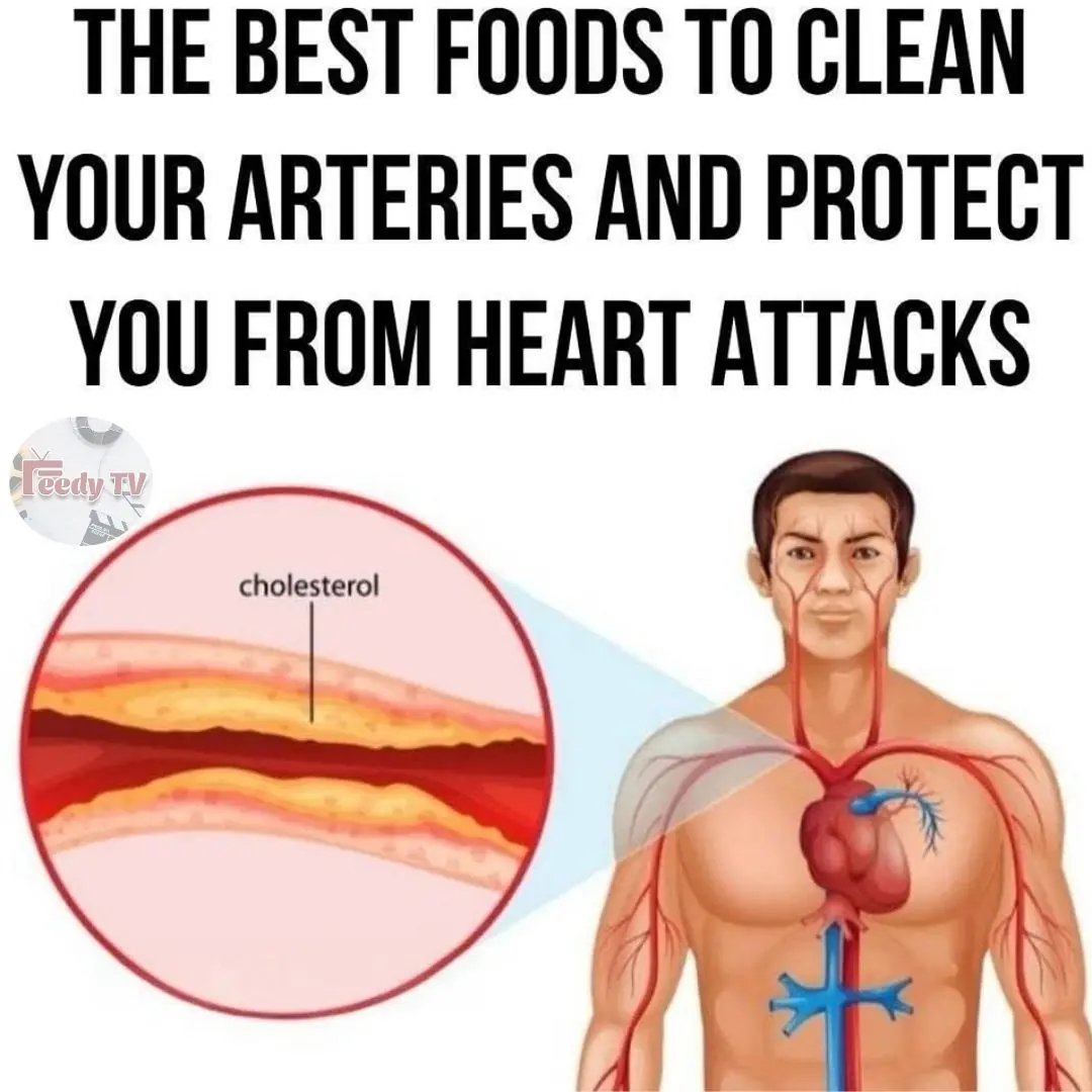 Clean Arteries: 10 Foods to Eat Daily