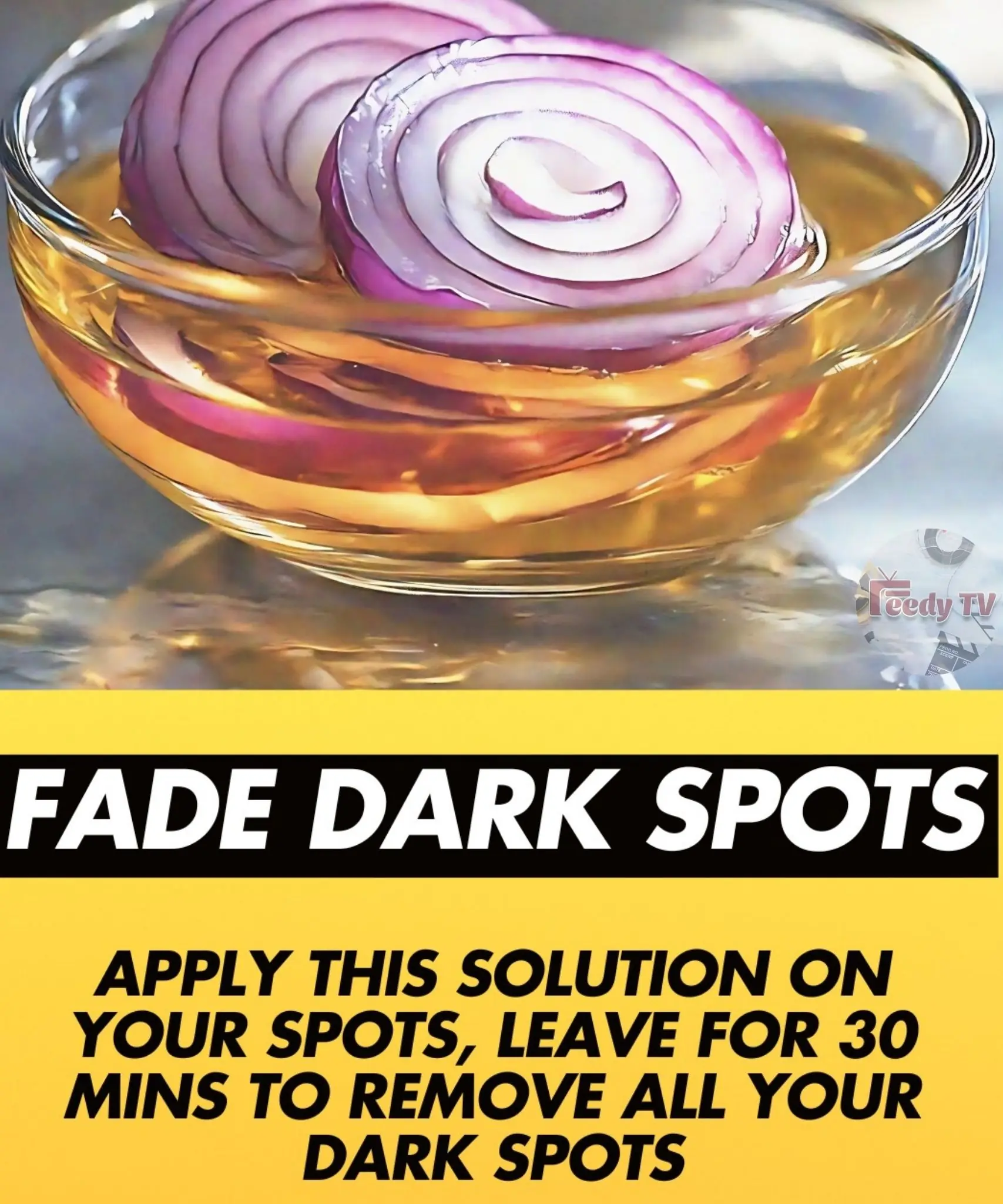 Onion and Apple Cider Vinegar to Fade Dark Spots