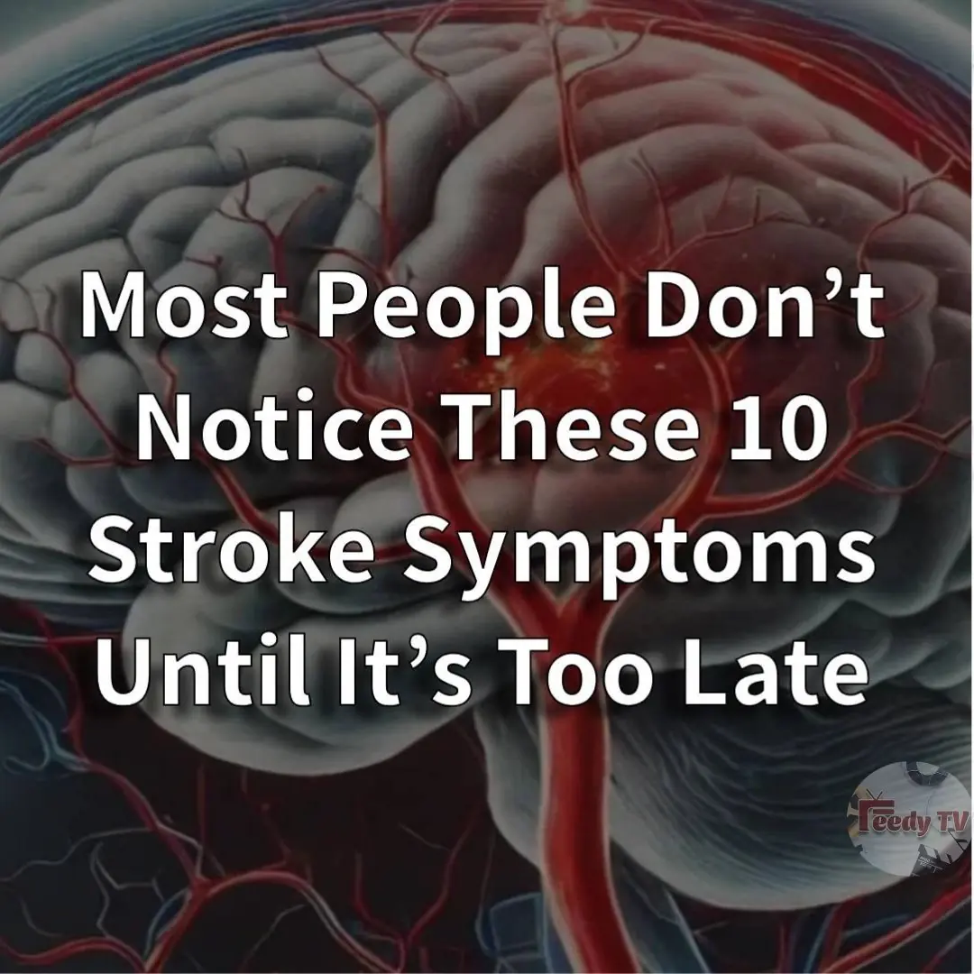 10 Life Saving Tips for Lowering Stroke Risk & Early Signs of Stroke