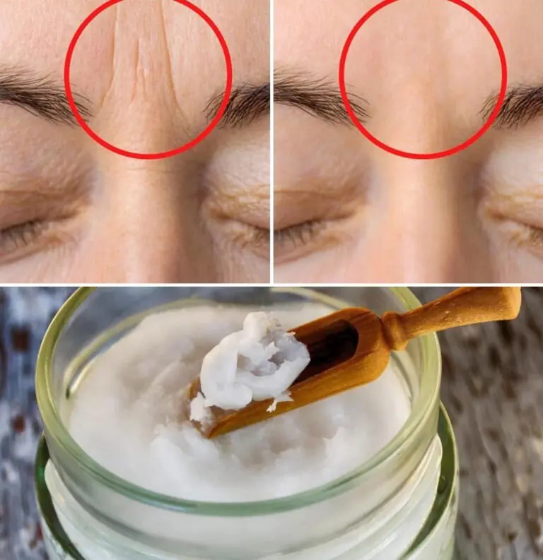 Rice Face Mask Recipes To Get Rid Of Wrinkles And Fine Lines For Skin Whitening