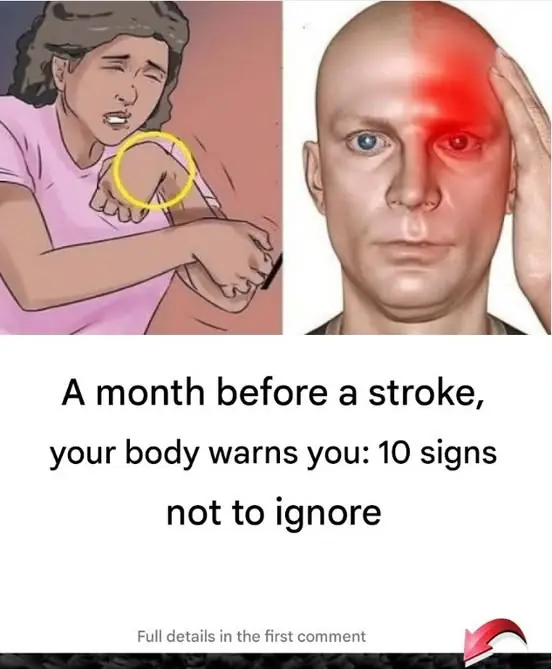 A month before a stroke, your body warns you: 10 signs not to ignore