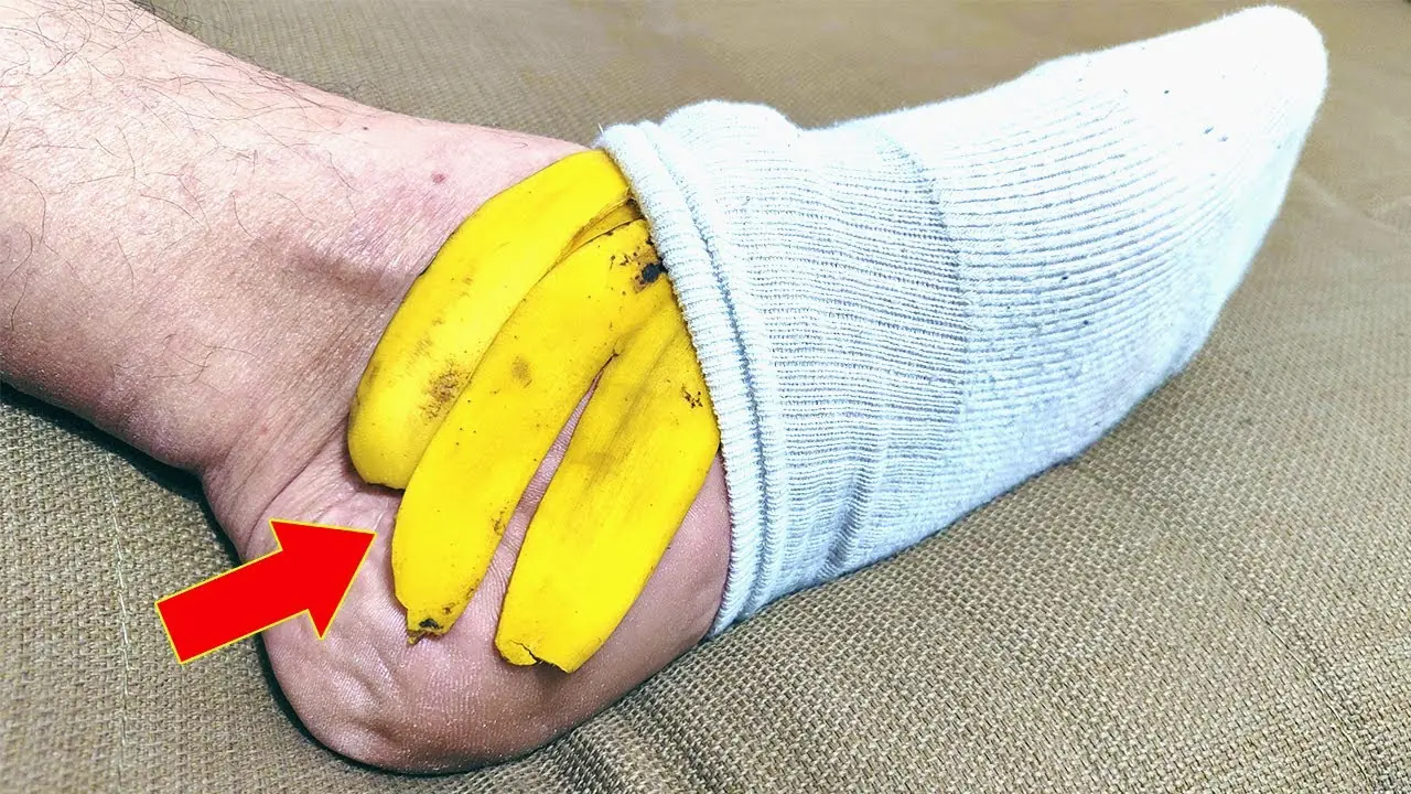 Banana Peel on Your Feet: A Surprising Natural Remedy You’ll Love