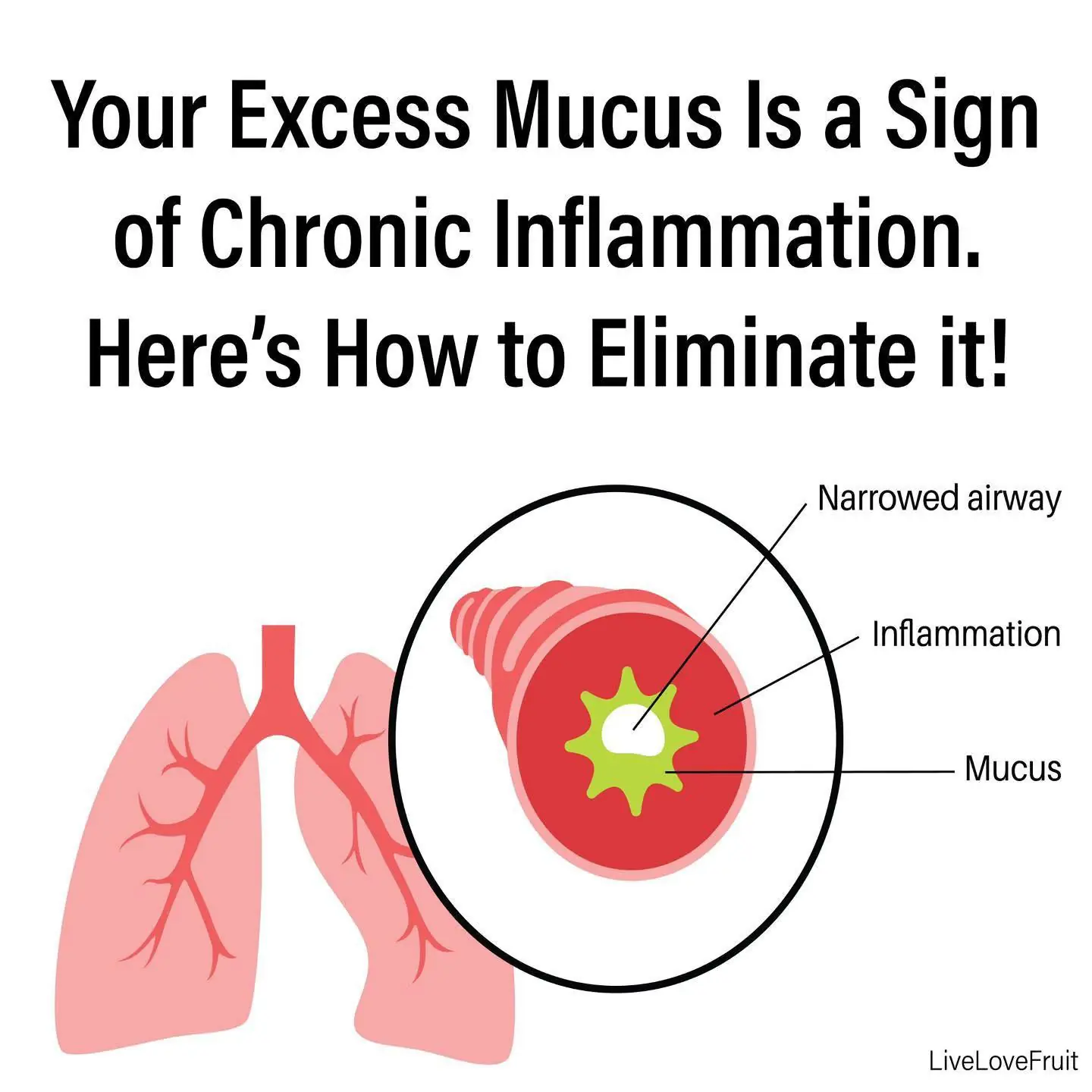 The Relationship Between Mucus and Inflammation and 5 Steps to Eliminate It