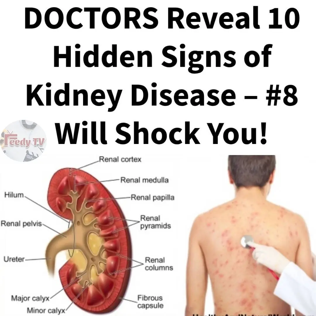 Early Signs of Kidney Disease & How to Protect Your Kidneys (Evidence Based)