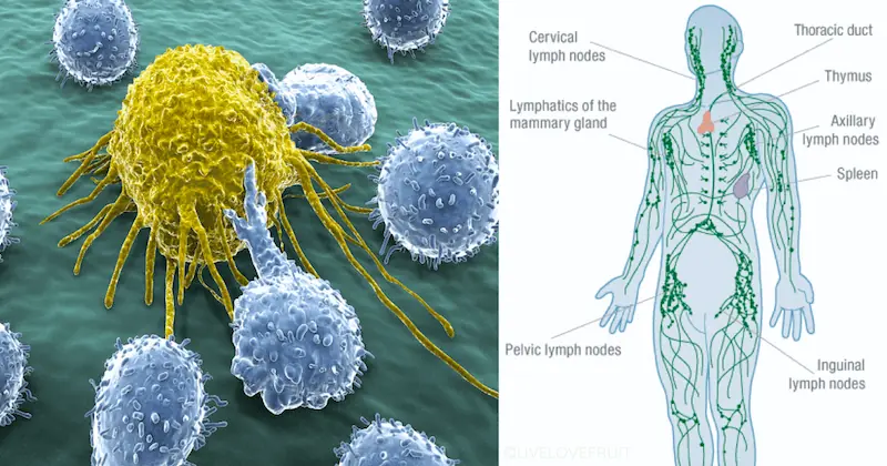 The Lymphatic System Is How Cancer Spreads