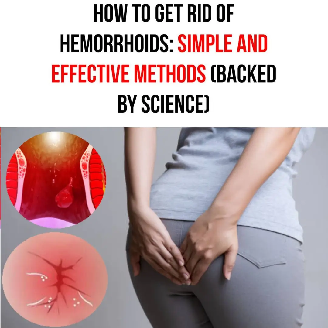 How to Get Rid of Hemorrhoids: Fast and Effective Ways