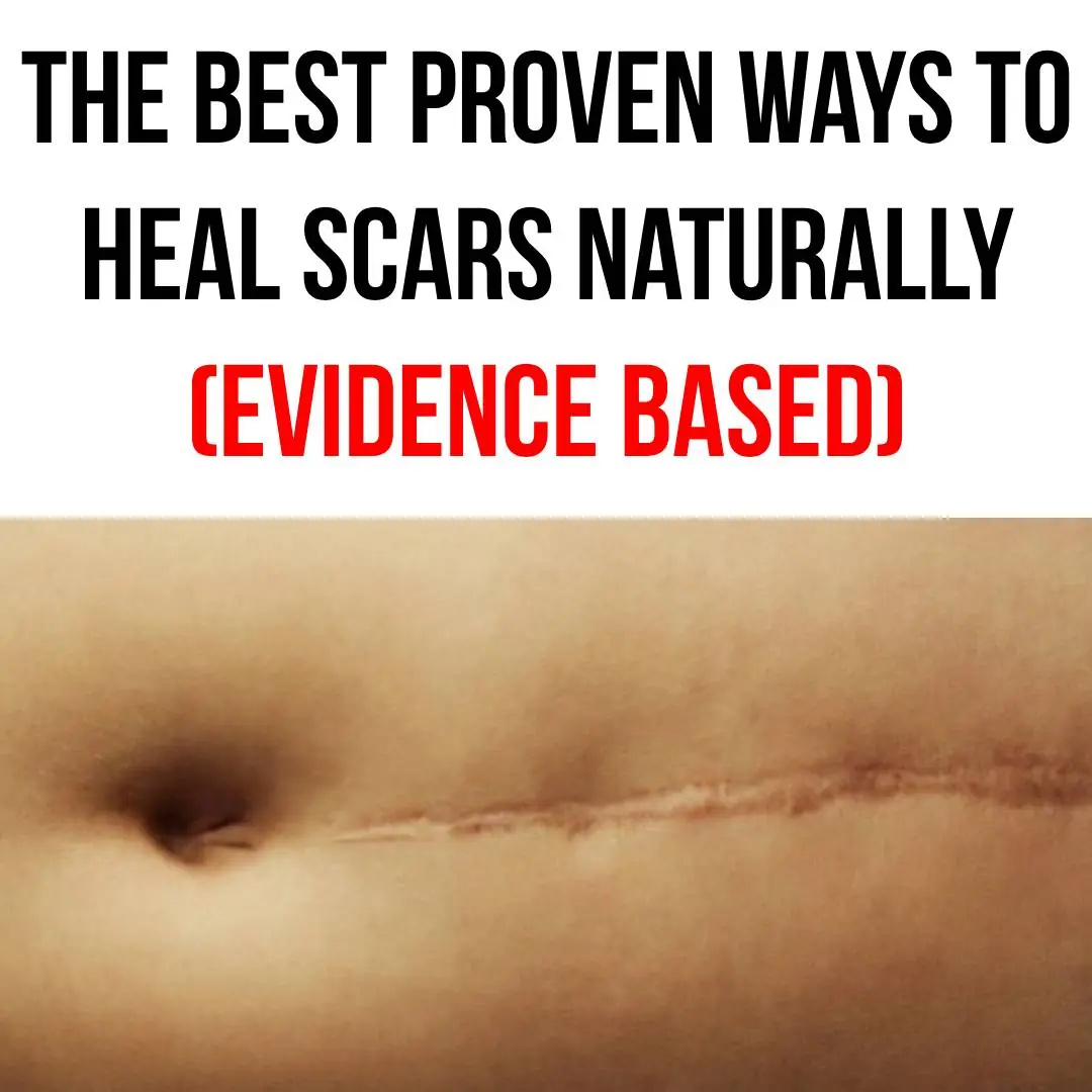 The Best Proven Ways to Heal Scars Naturally