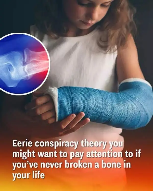 If You’ve Never Broken a Bone There’s a Strange Conspiracy Theory You May Want to Pay Attention To