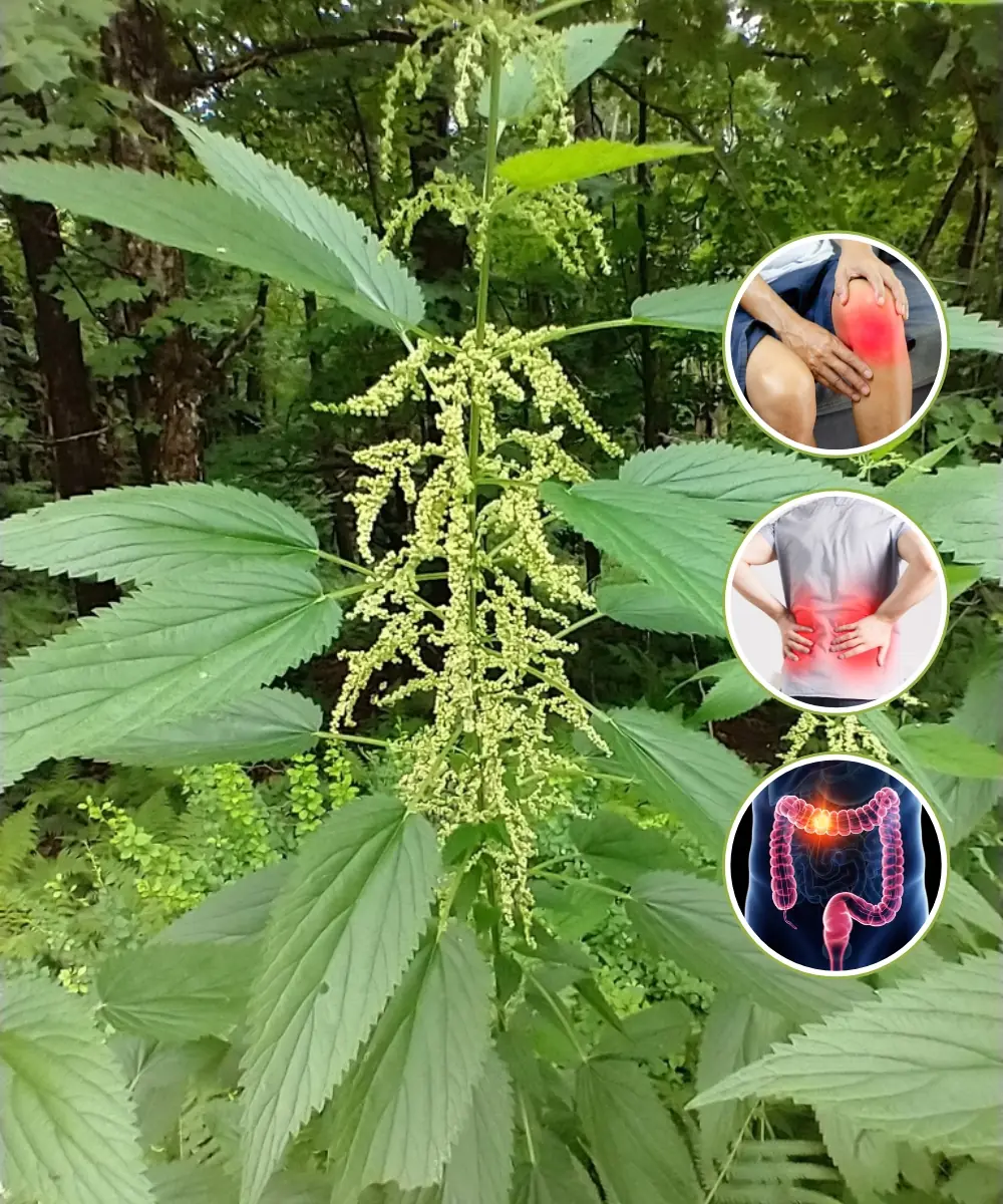 Nettle: A Natural Remedy to Combat 20 Health Problems