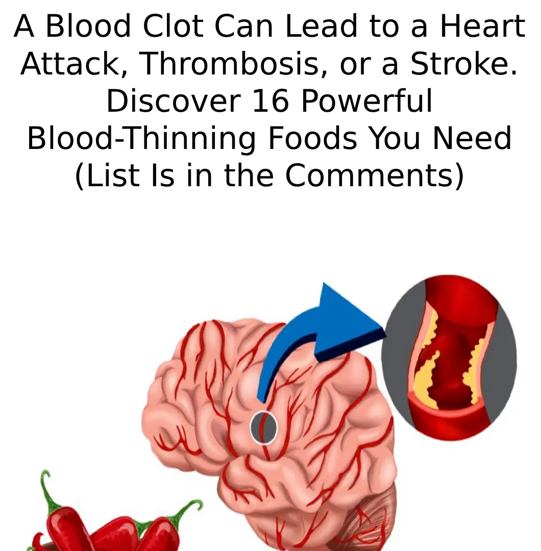 Natural Blood Thinners: Proven Foods, Supplements and Vitamins to Thin Blood (Evidence Based)