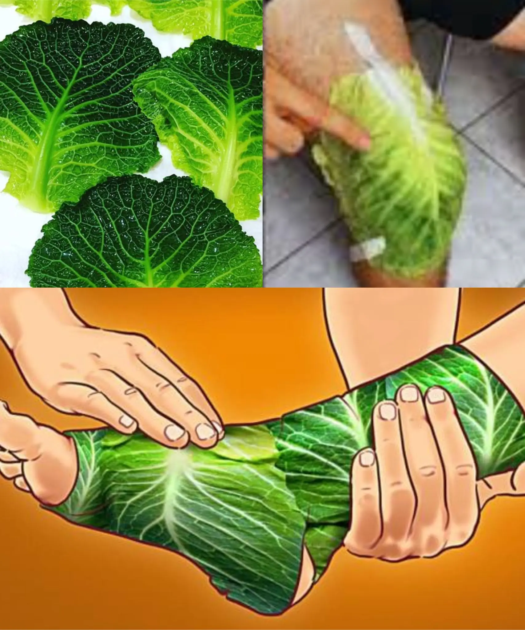 Natural Relief for Varicose Veins with Cabbage Leaves