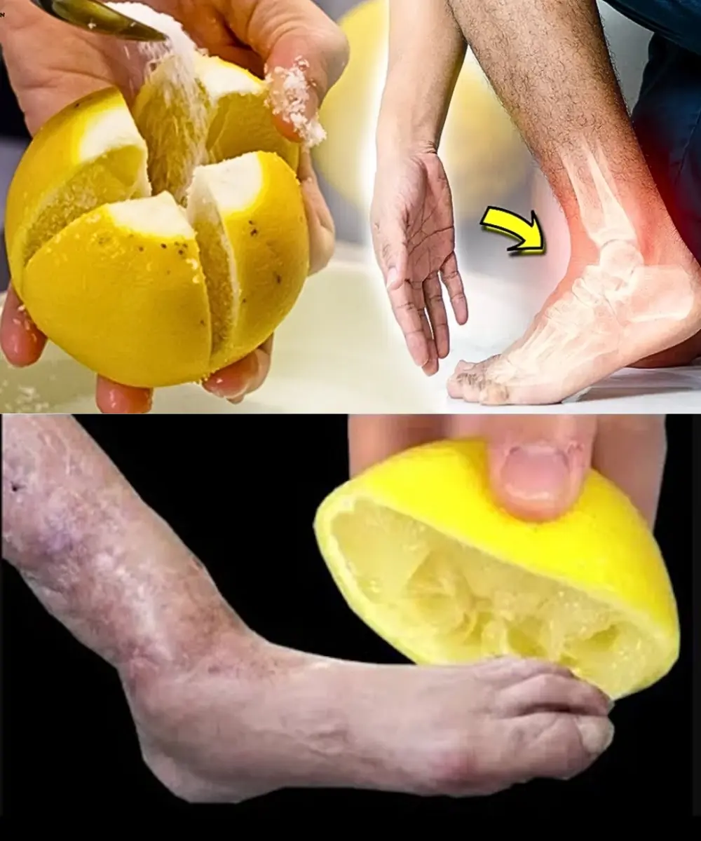 Goodbye Joint Pain! Natural Remedy for Leg Pain, Rheumatism, Varicose Veins & Headaches