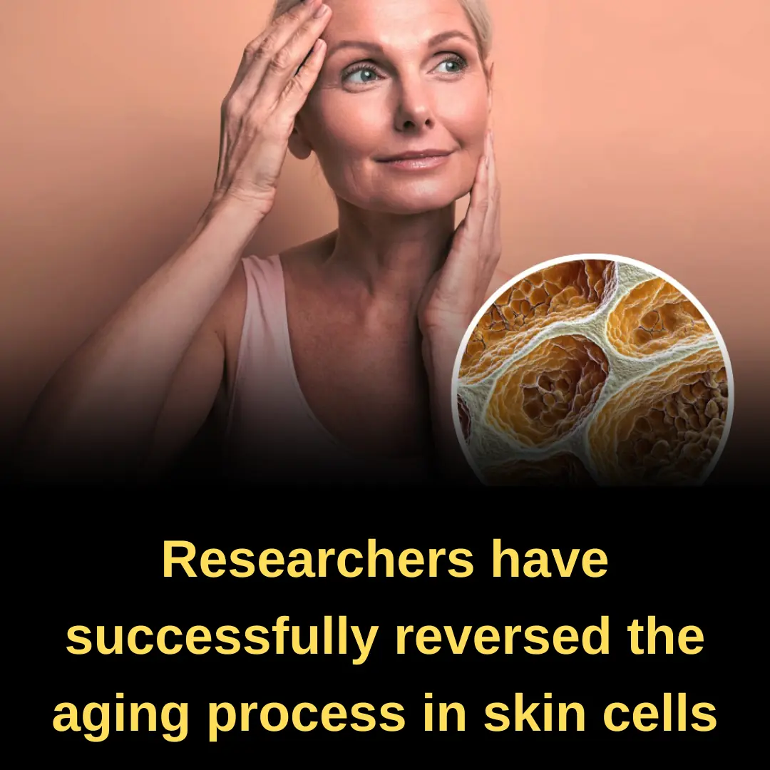 Scientists Rejuvenate Skin Of 53-Year-Old Woman To That Of 23-Year-Old In Groundbreaking Experiment