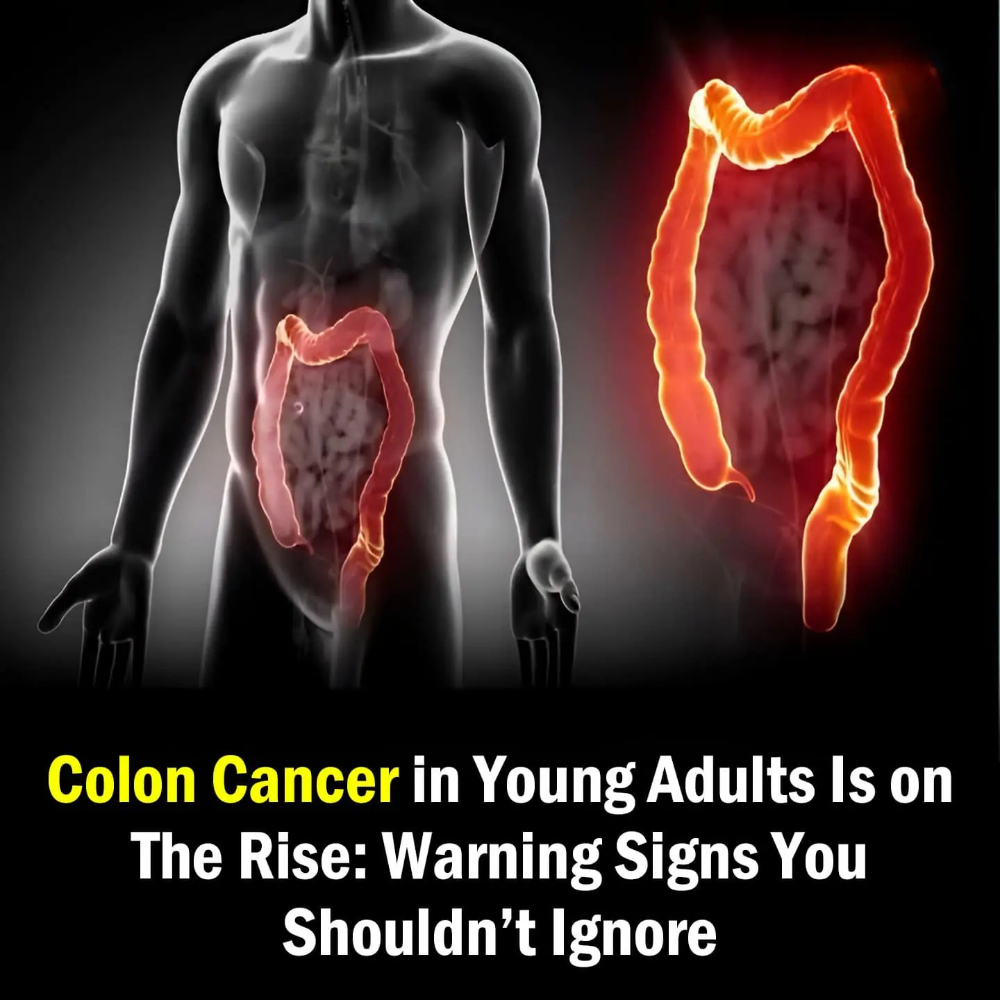 5 Unusual Signs Of Colon Cancer People Accidentally Ignore For Years