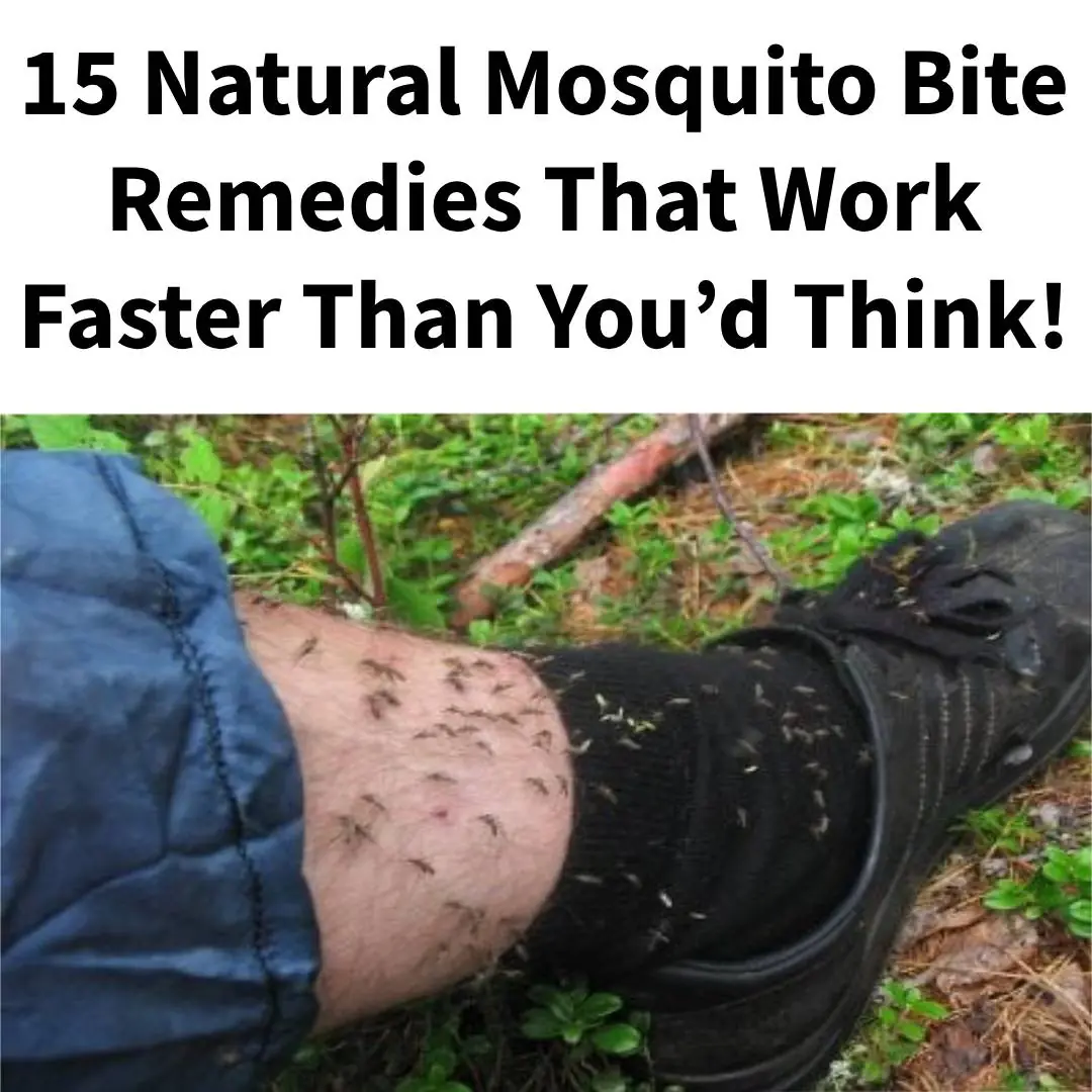 15 Best Natural Ways To Relieve Mosquito Bites