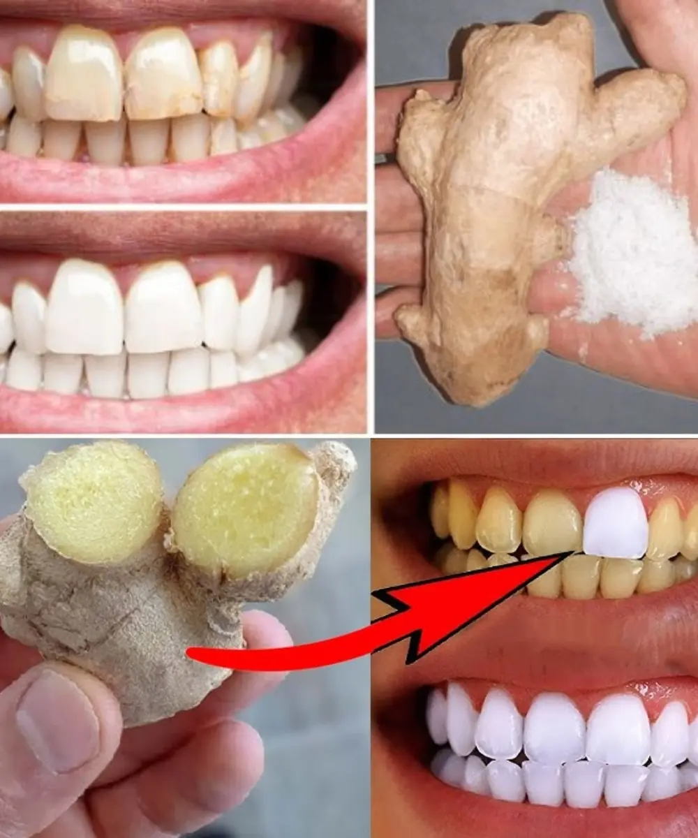 Whiten Your Teeth and Freshen Your Breath Instantly with Ginger and This White Powder