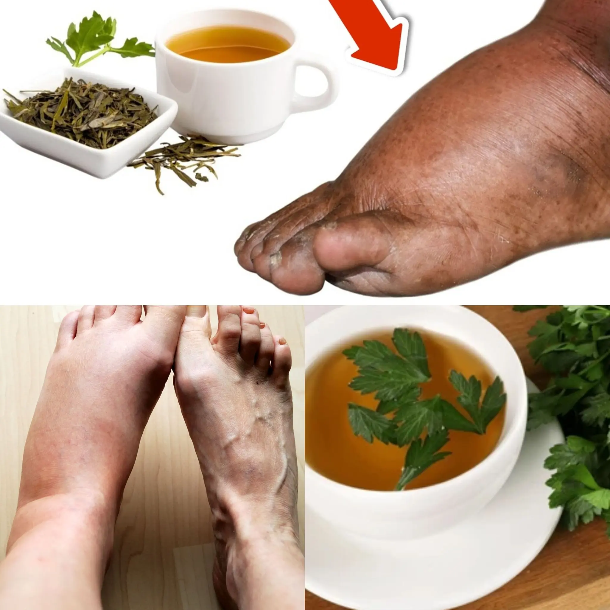 Drink Parsley Tea and Say Goodbye to Swollen Legs, Ankles, and Feet! 🤯💥