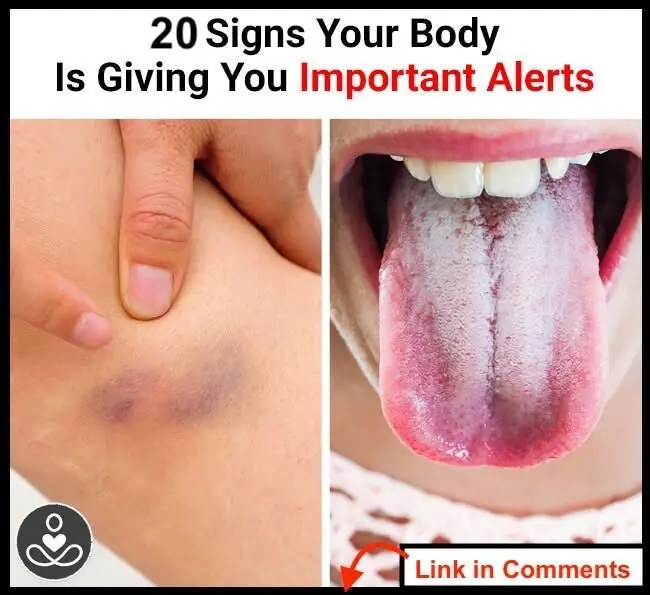 20 Signs Your Body is Out of Balance, and Something is Wrong