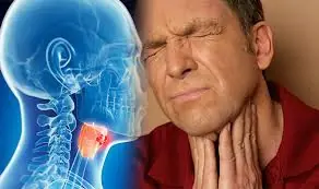 10 Warning Signs of Throat Cancer You Shouldn’t Ignore